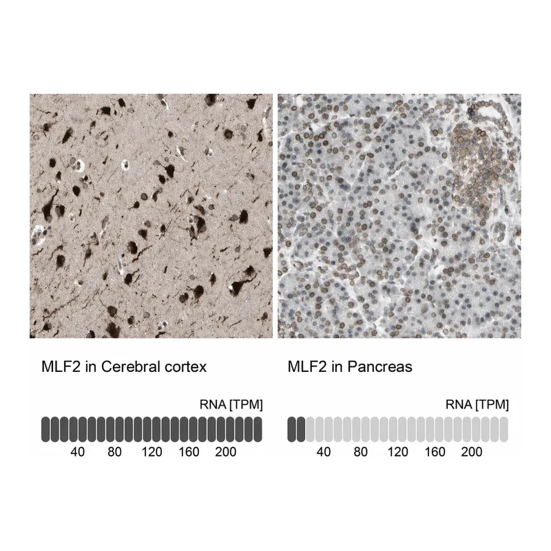 Atlas Antibodies Anti-MLF2 Antibody