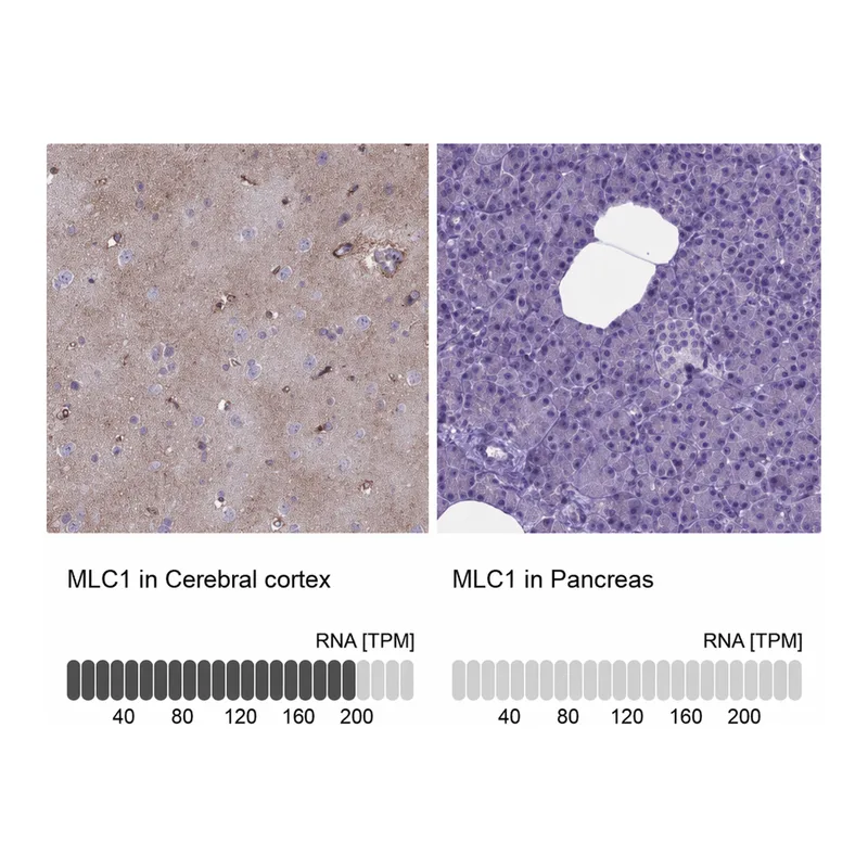 Atlas Antibodies Anti-MLC1 Antibody