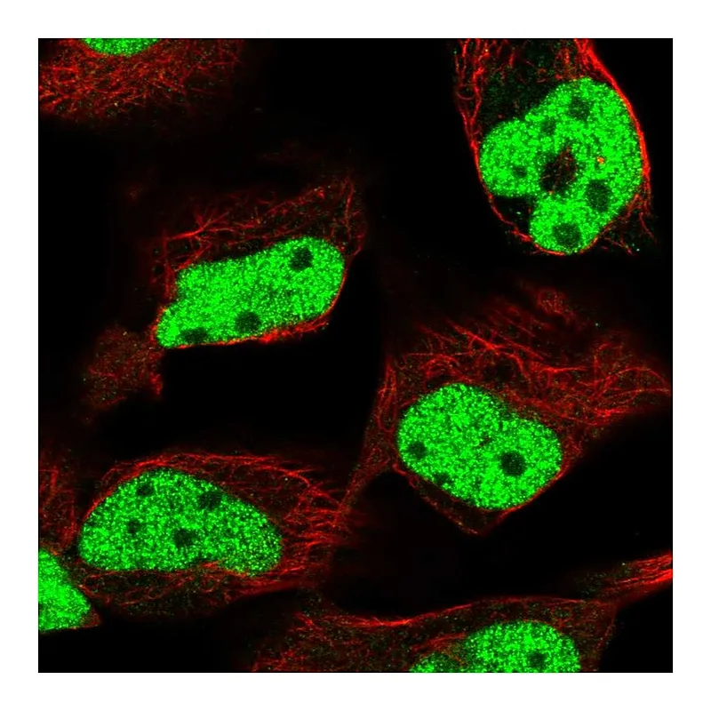 Atlas Antibodies Anti-MLH1 Antibody
