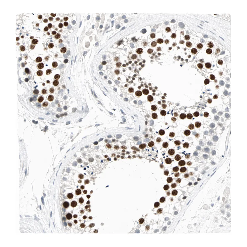 Atlas Antibodies Anti-MLLT10 Antibody