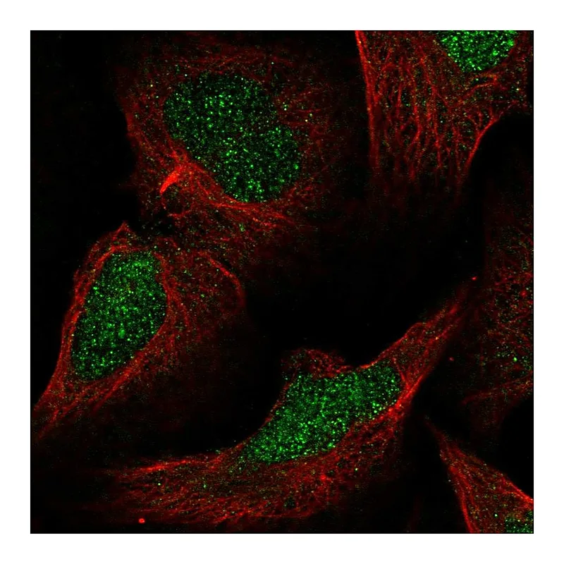 Atlas Antibodies Anti-MLH3 Antibody