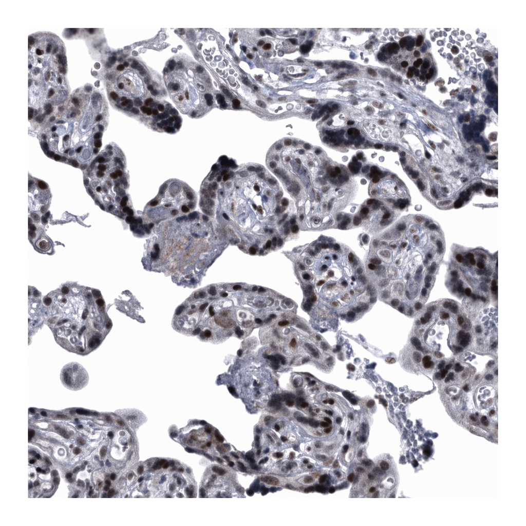 Atlas Antibodies Anti-MLLT1 Antibody