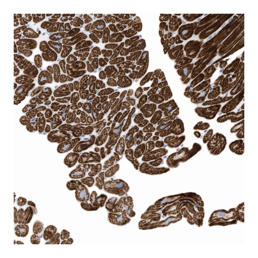 Atlas Antibodies Anti-MLYCD Antibody