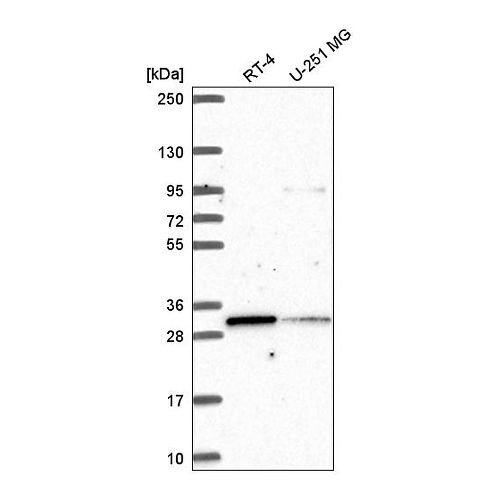 Atlas Antibodies Anti-MLX Antibody