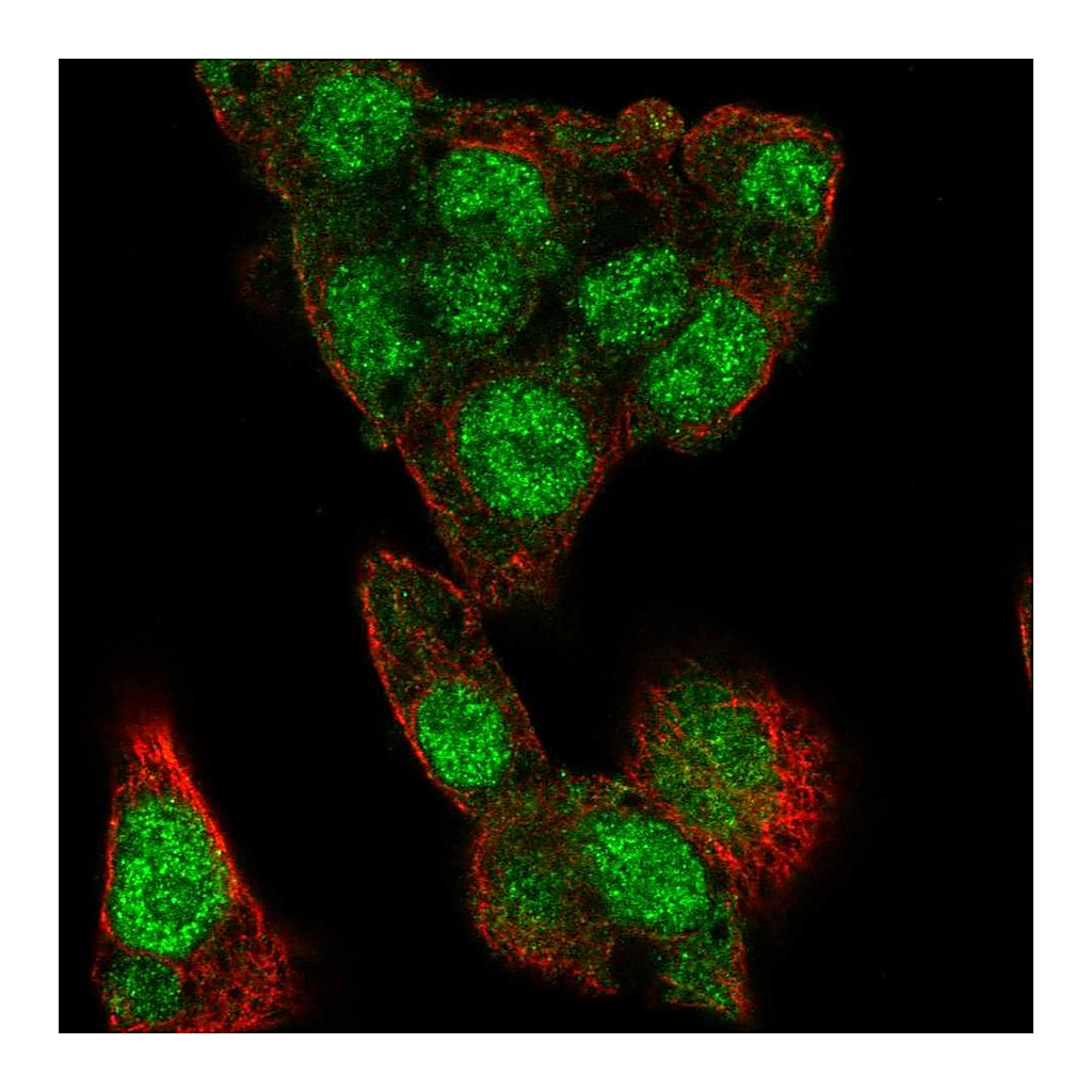 Atlas Antibodies Anti-MLXIPL Antibody