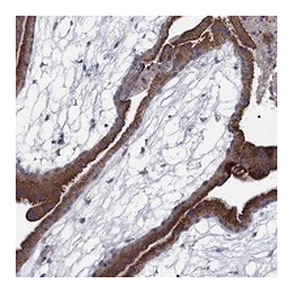 Atlas Antibodies Anti-MMAA Antibody