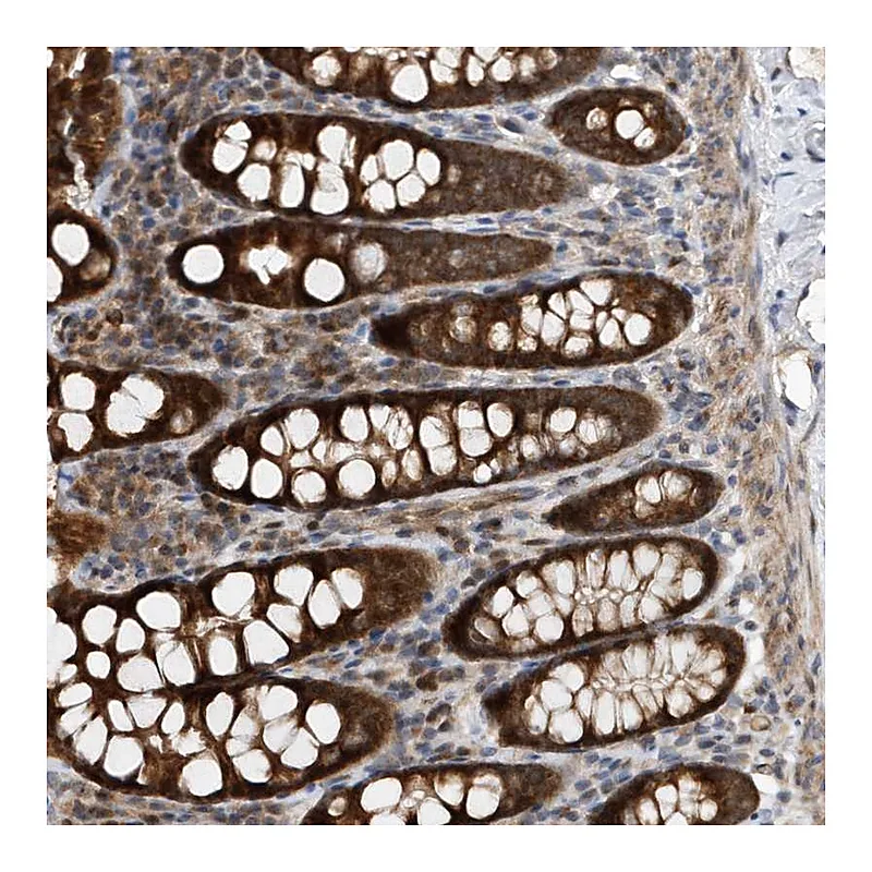 Atlas Antibodies Anti-MMAA Antibody