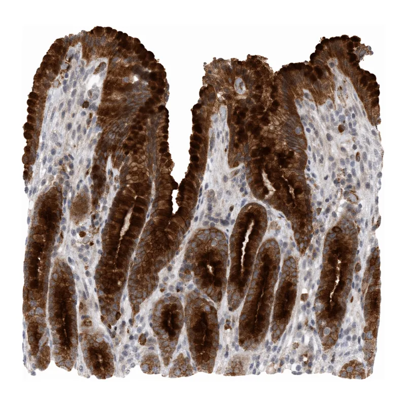 Atlas Antibodies Anti-MLPH Antibody
