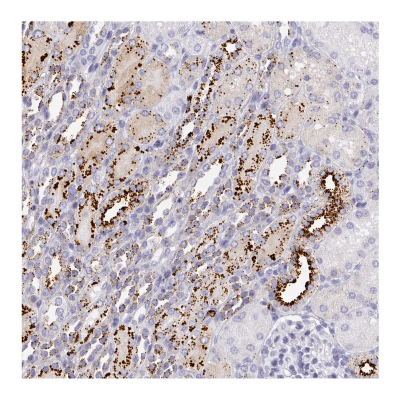 Atlas Antibodies Anti-MMACHC Antibody