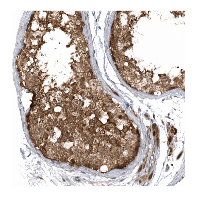 Atlas Antibodies Anti-MMADHC Antibody