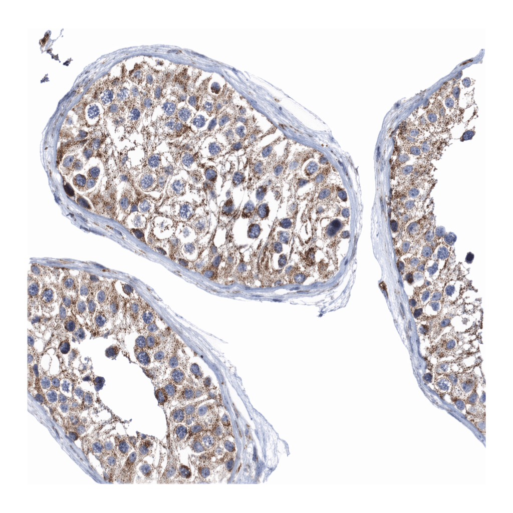 Atlas Antibodies Anti-MMEL1 Antibody