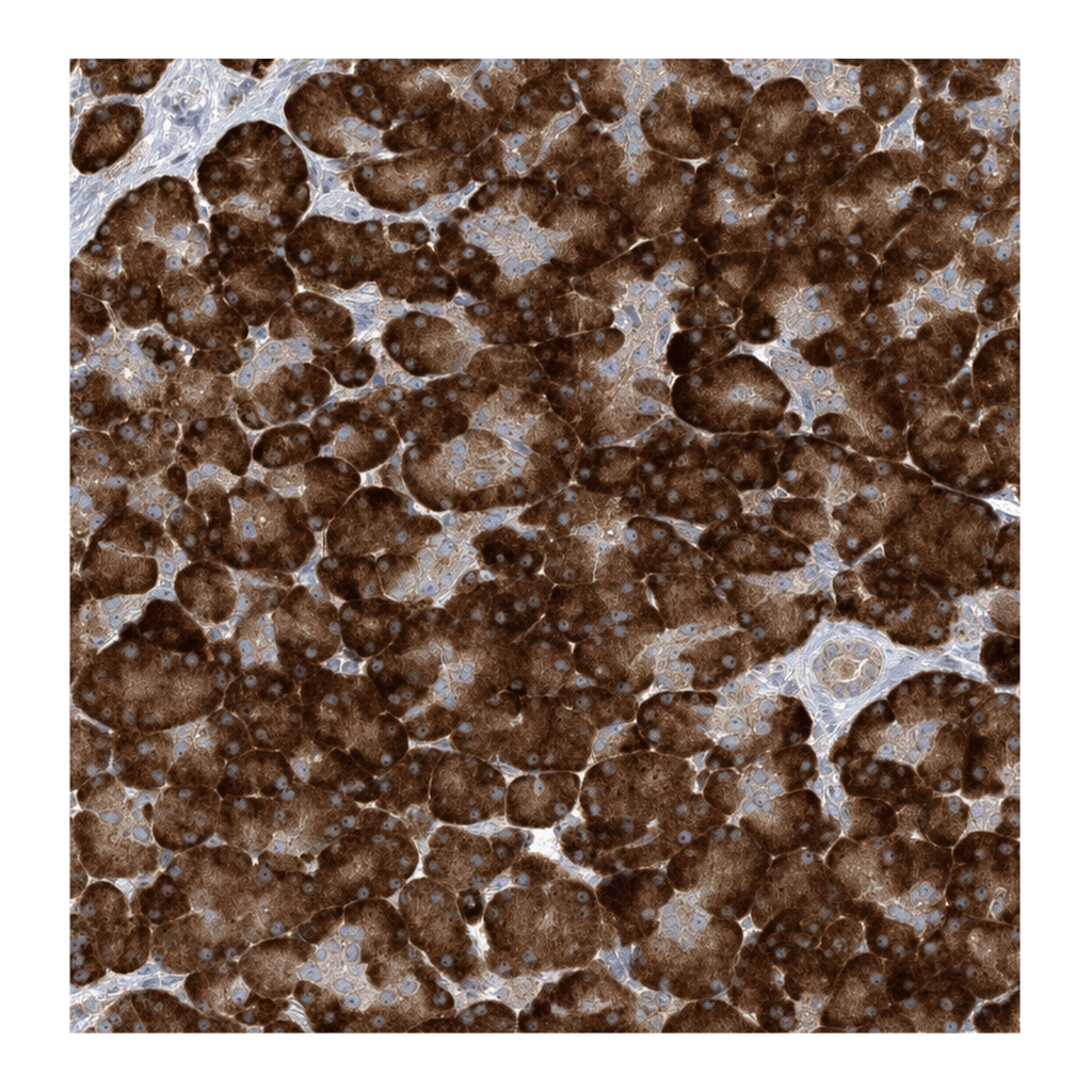 Atlas Antibodies Anti-MMADHC Antibody