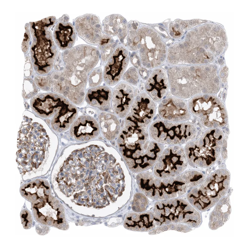 Atlas Antibodies Anti-MMGT1 Antibody