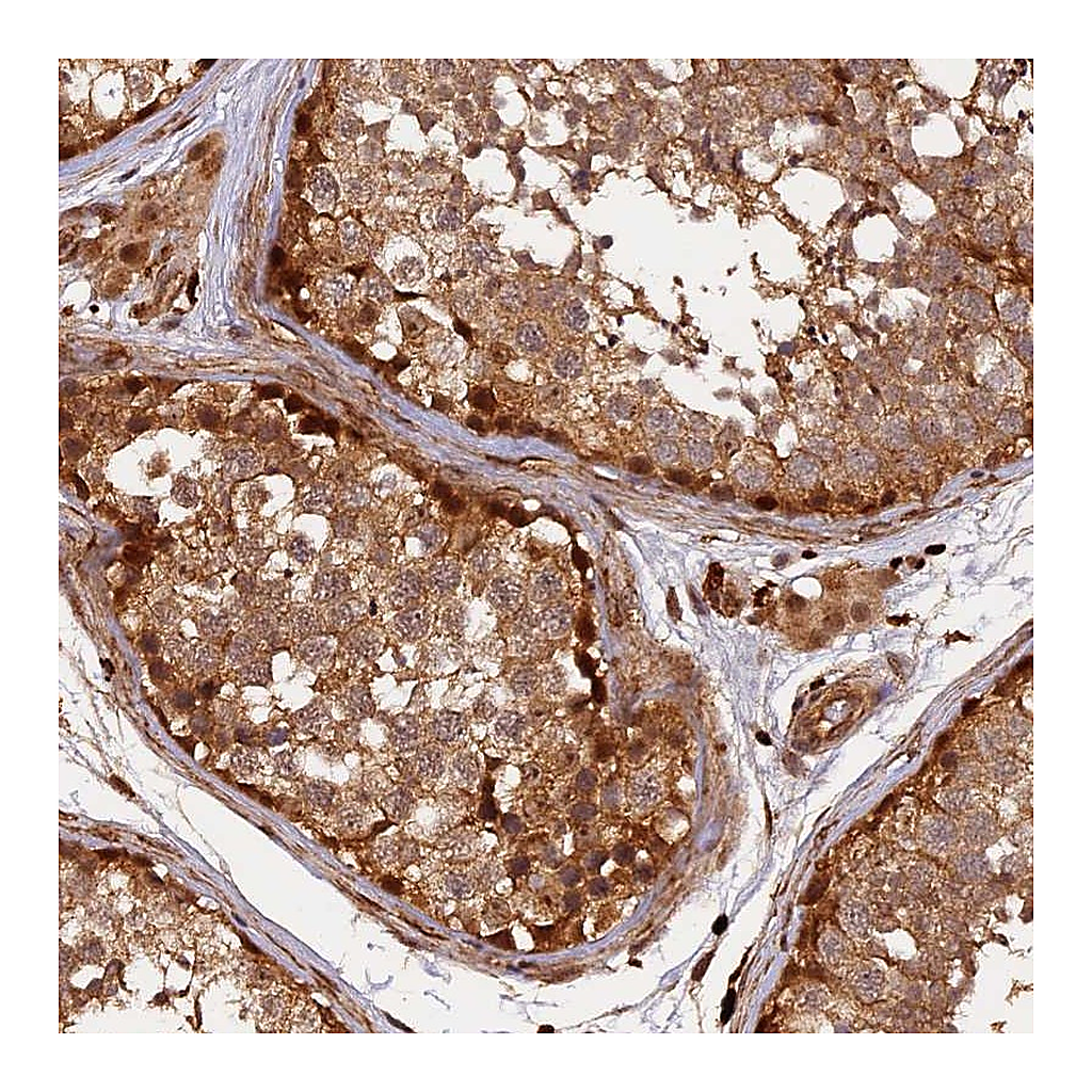 Atlas Antibodies Anti-MMP15 Antibody
