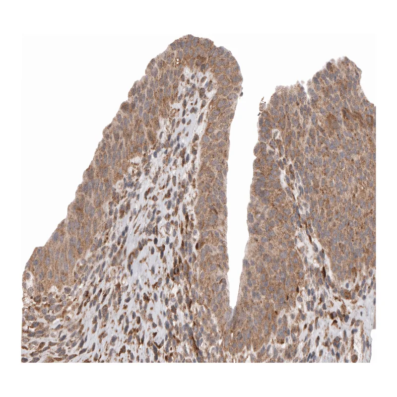 Atlas Antibodies Anti-MMP2 Antibody
