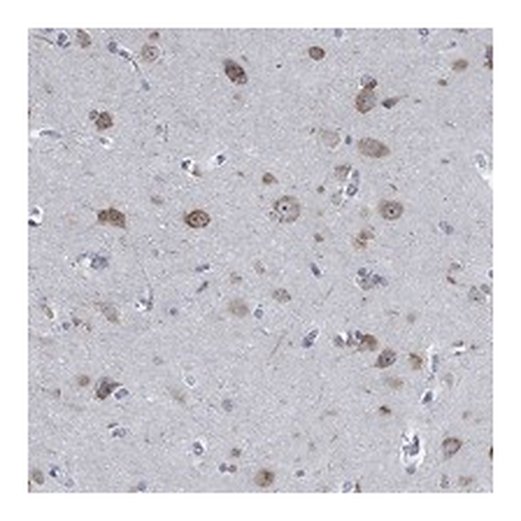 Atlas Antibodies Anti-MMP24 Antibody
