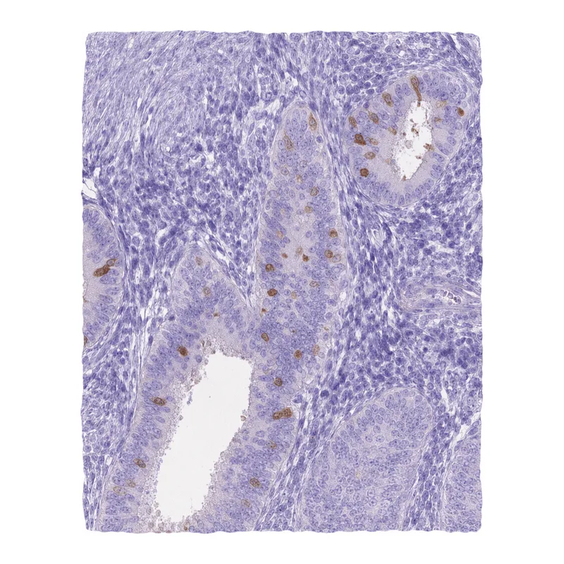 Atlas Antibodies Anti-MMP11 Antibody
