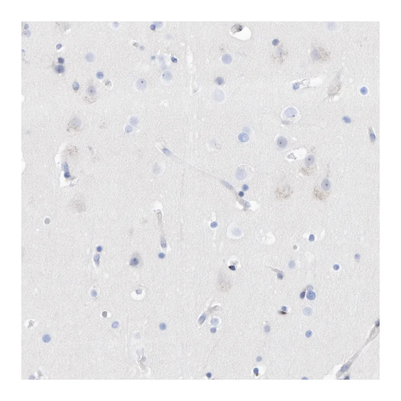 Atlas Antibodies Anti-MMP16 Antibody