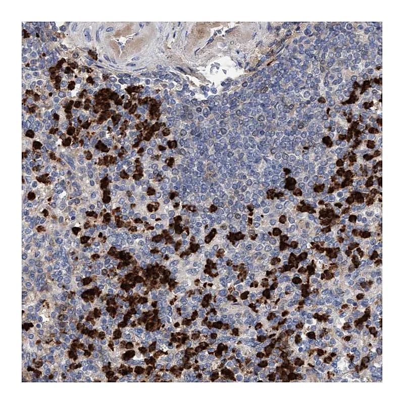 Atlas Antibodies Anti-MMP8 Antibody
