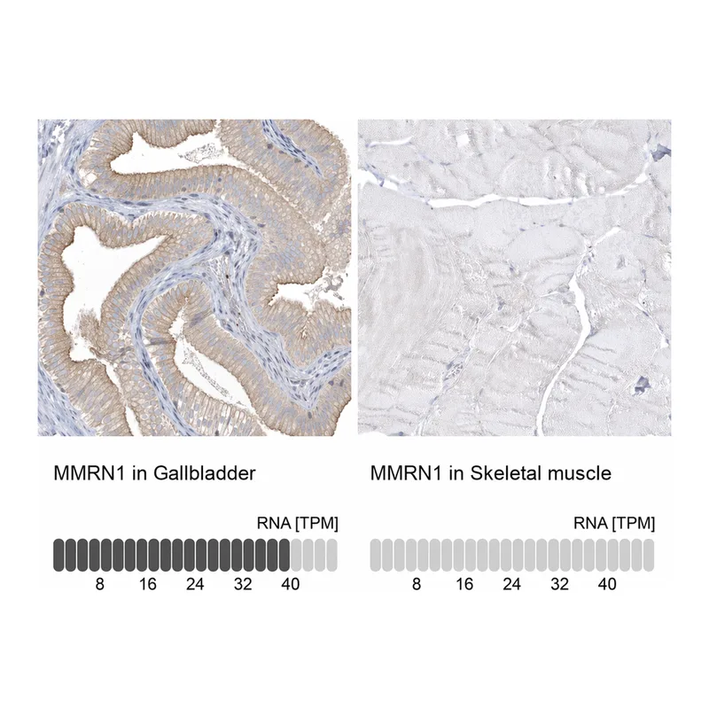 Atlas Antibodies Anti-MMRN1 Antibody