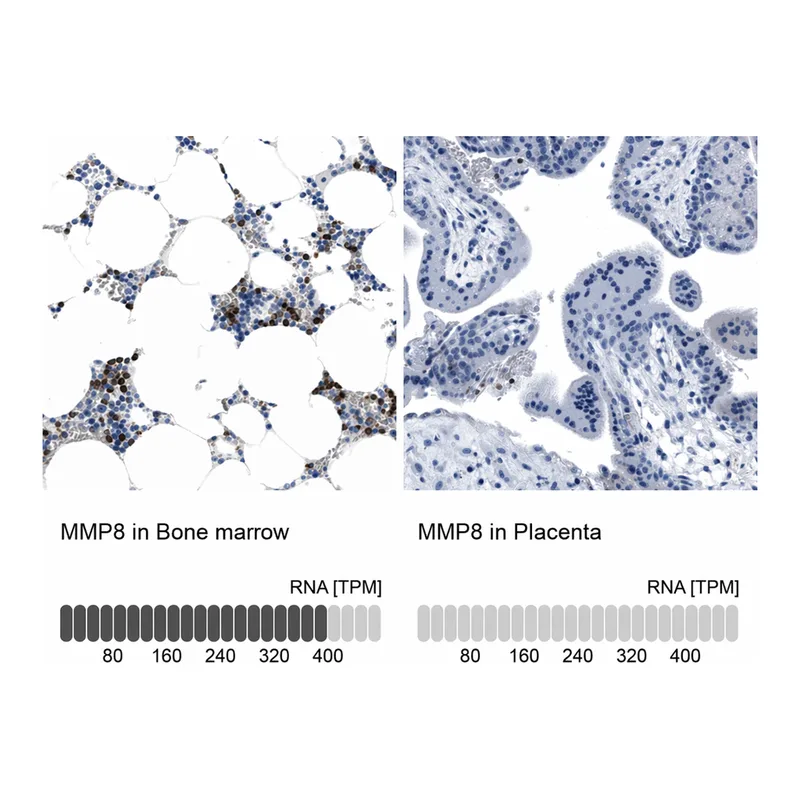 Atlas Antibodies Anti-MMP8 Antibody