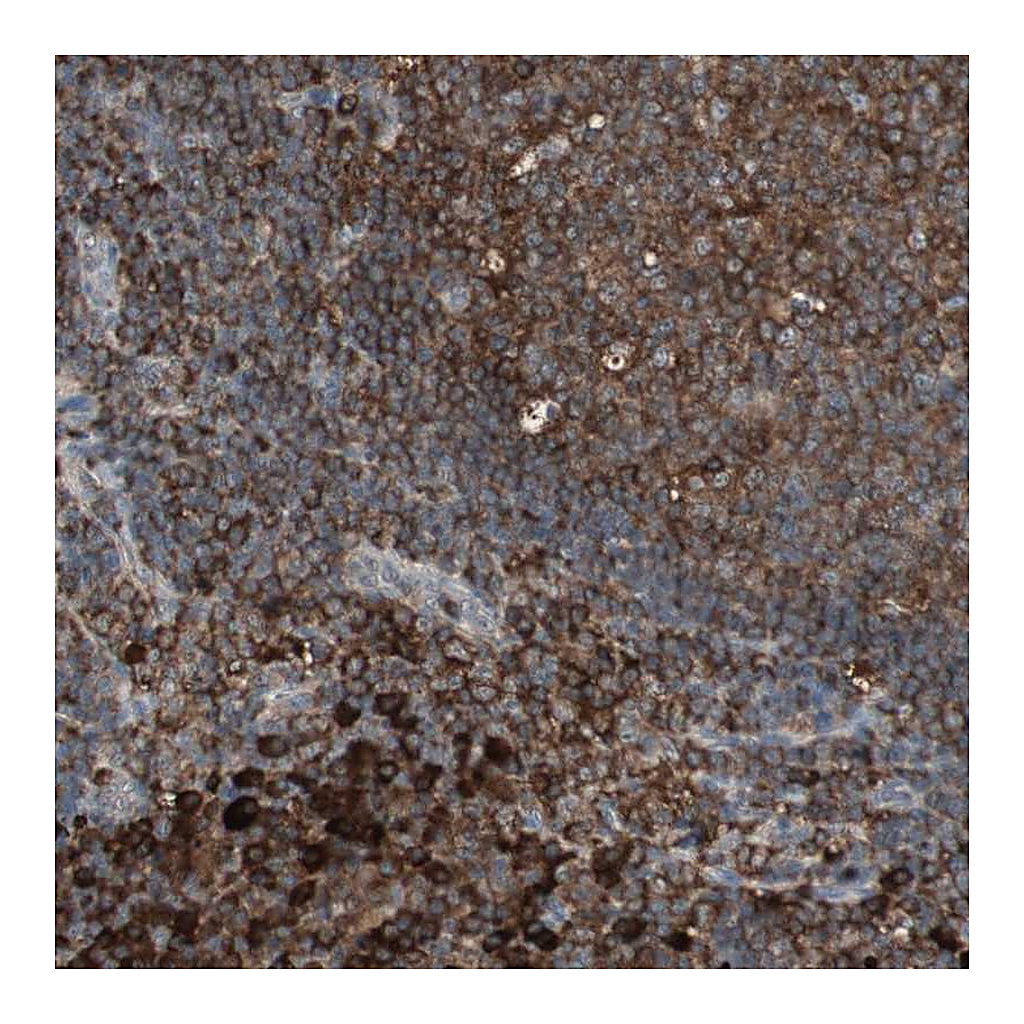 Atlas Antibodies Anti-MMP3 Antibody