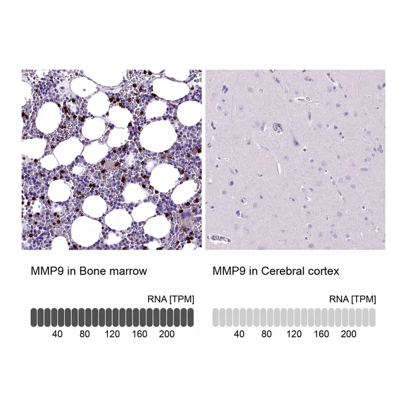 Atlas Antibodies Anti-MMP9 Antibody