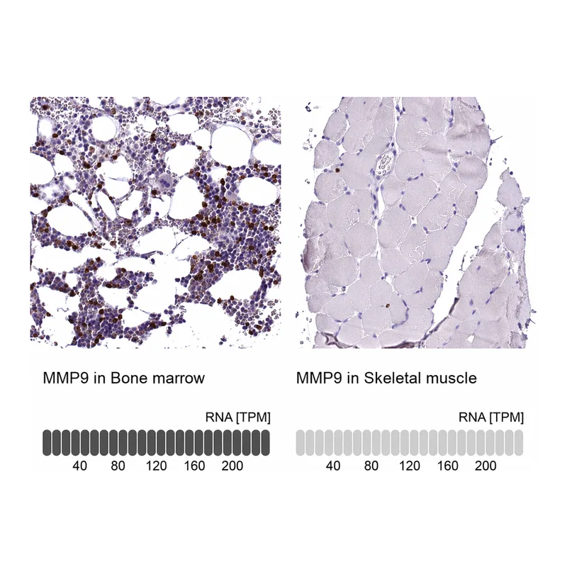 Atlas Antibodies Anti-MMP9 Antibody