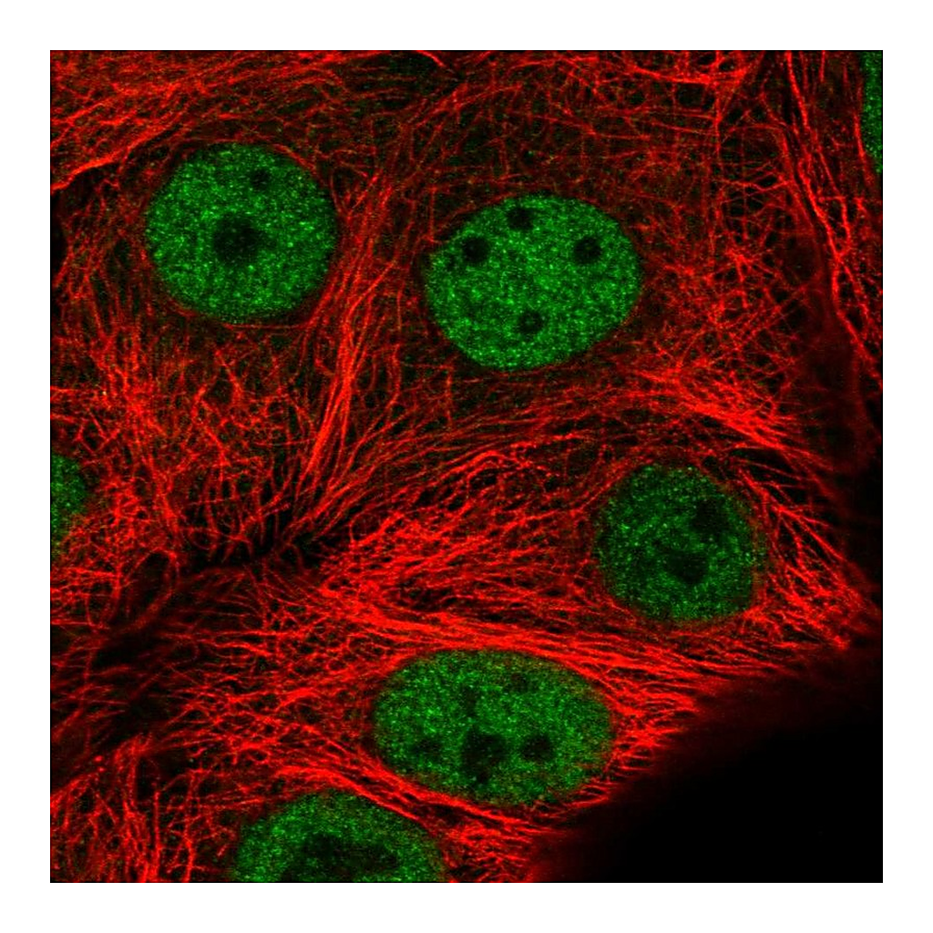 Atlas Antibodies Anti-MMS19 Antibody