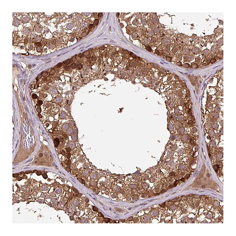 Atlas Antibodies Anti-MMS19 Antibody