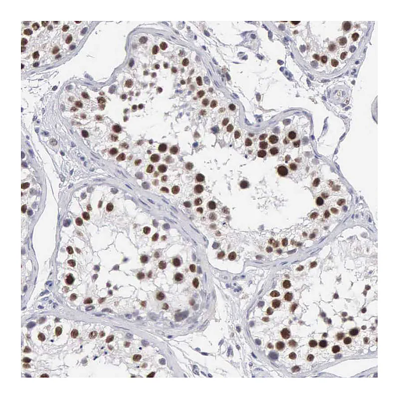 Atlas Antibodies Anti-MNAT1 Antibody