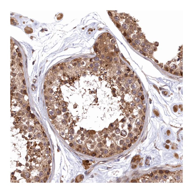 Atlas Antibodies Anti-MNS1 Antibody