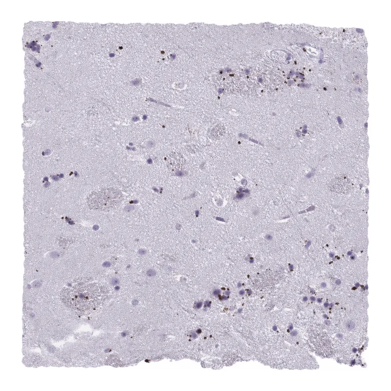 Atlas Antibodies Anti-MOBP Antibody