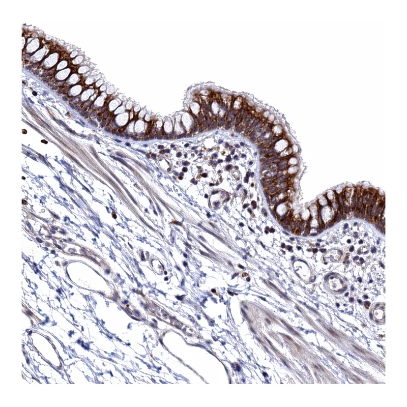 Atlas Antibodies Anti-MOB2 Antibody