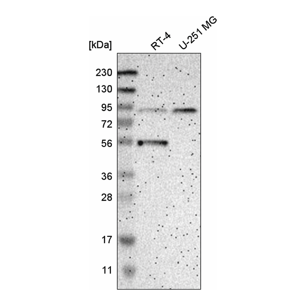 Atlas Antibodies Anti-MOGS Antibody