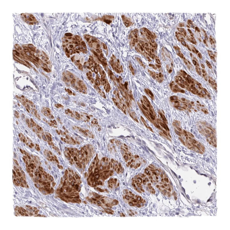Atlas Antibodies Anti-MOCS1 Antibody