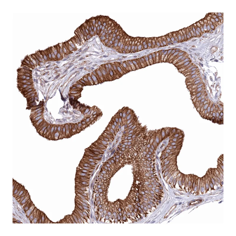 Atlas Antibodies Anti-MOGAT1 Antibody