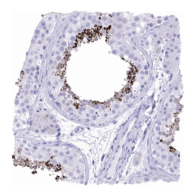 Atlas Antibodies Anti-MON1A Antibody