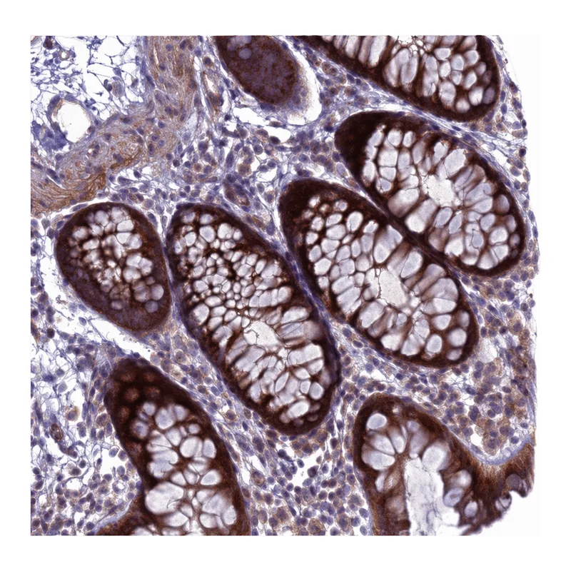 Atlas Antibodies Anti-MON1B Antibody