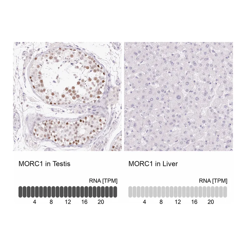 Atlas Antibodies Anti-MORC1 Antibody