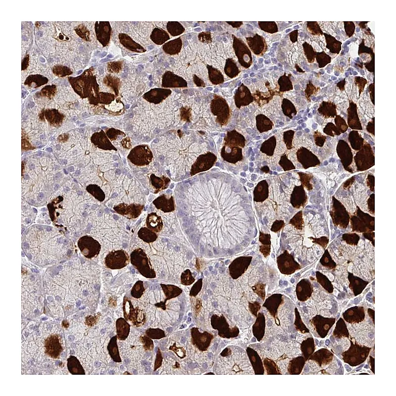 Atlas Antibodies Anti-MON2 Antibody