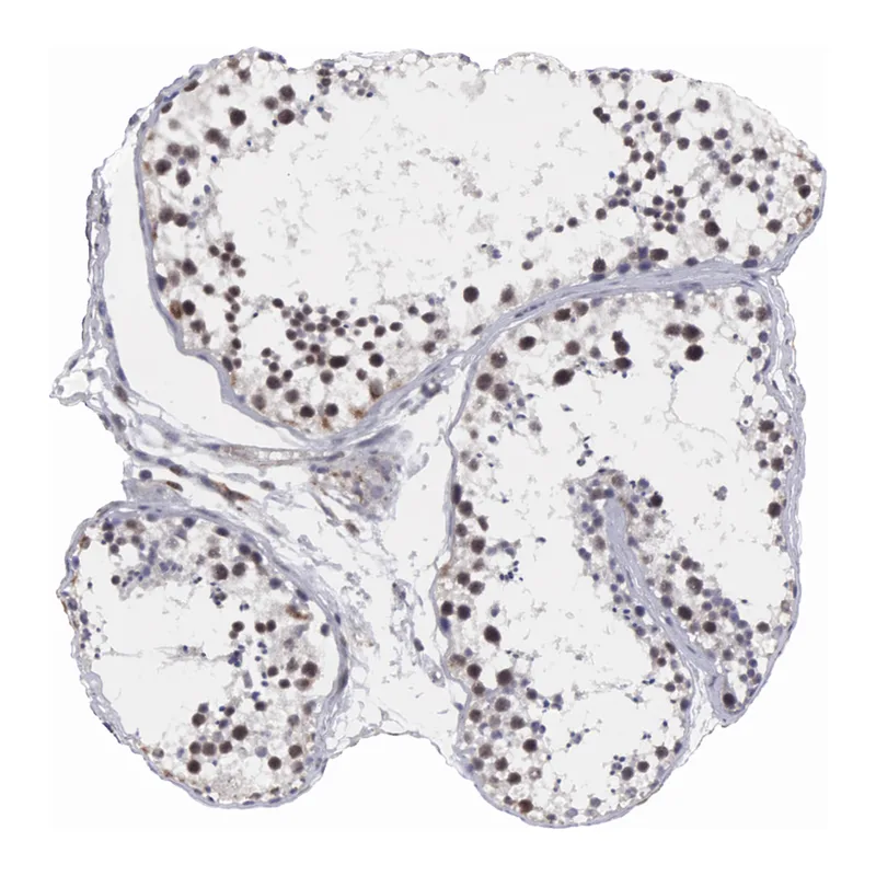 Atlas Antibodies Anti-MORC2 Antibody