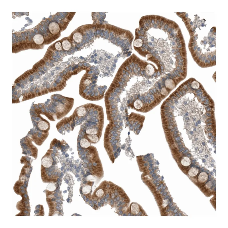 Atlas Antibodies Anti-MOGS Antibody