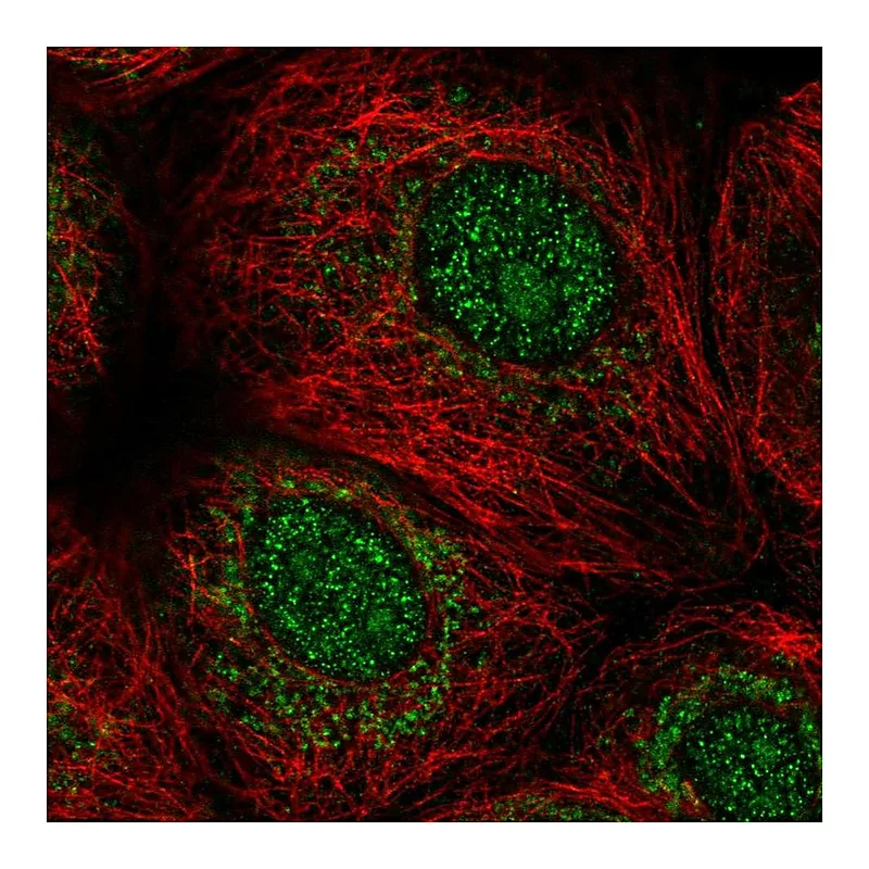 Atlas Antibodies Anti-MORN1 Antibody