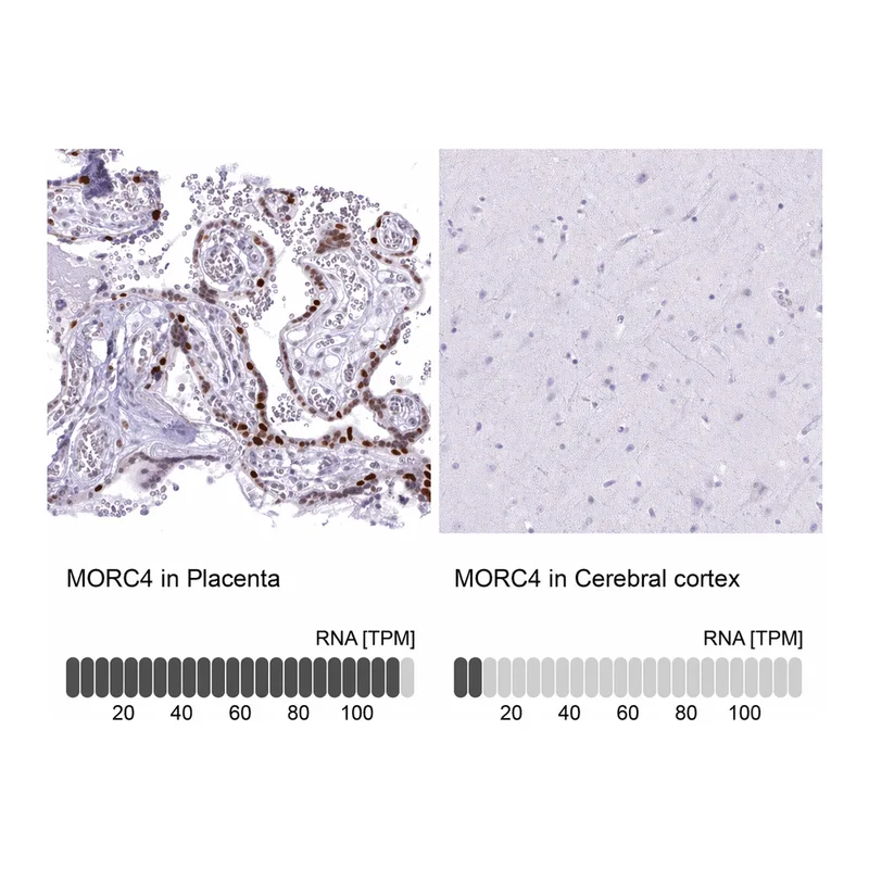 Atlas Antibodies Anti-MORC4 Antibody