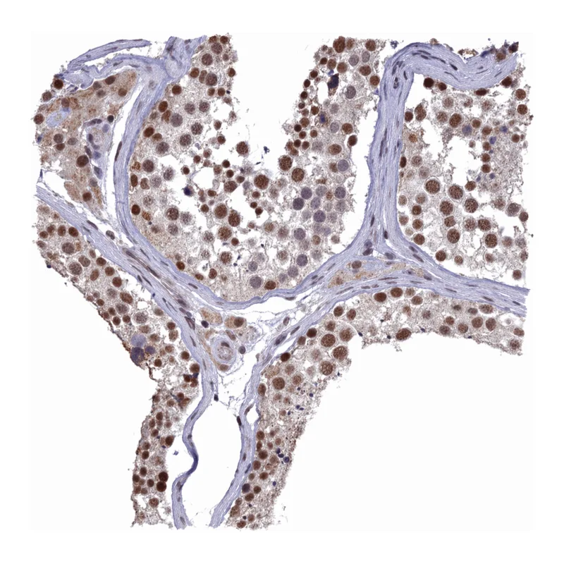 Atlas Antibodies Anti-MORF4L1 Antibody