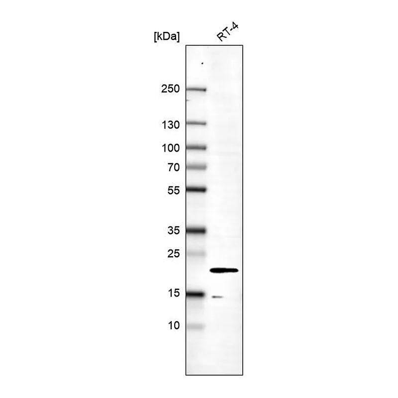 Atlas Antibodies Anti-MOSPD1 Antibody