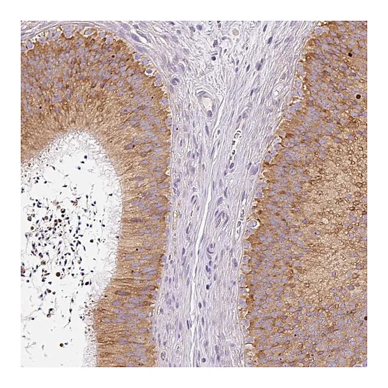 Atlas Antibodies Anti-MORN4 Antibody