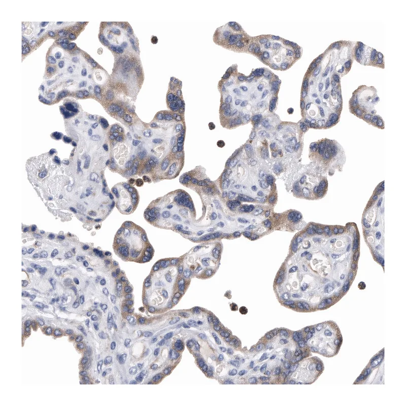 Atlas Antibodies Anti-MOSPD2 Antibody