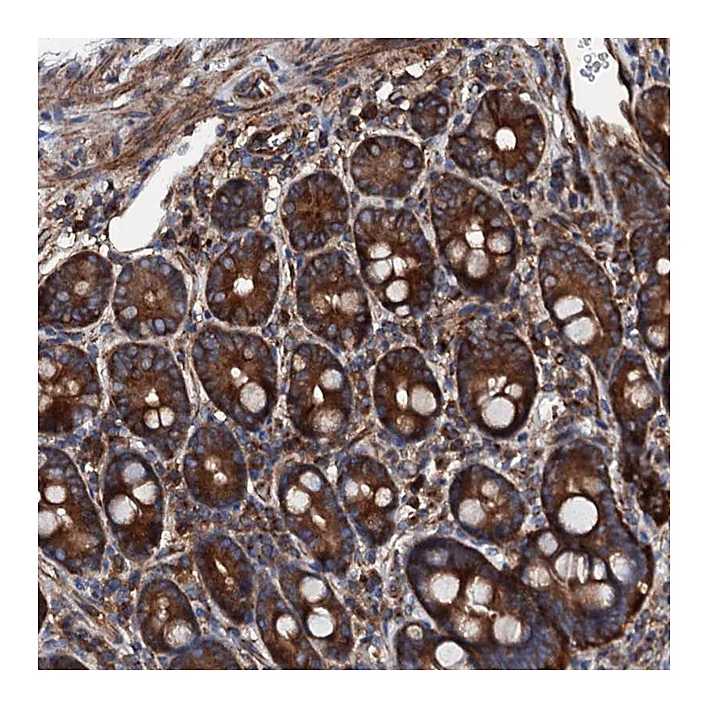 Atlas Antibodies Anti-MOS Antibody